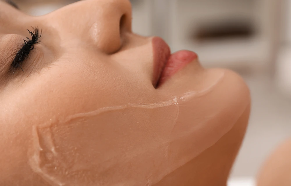 Chemical Peels 101: Everything You Need to Know