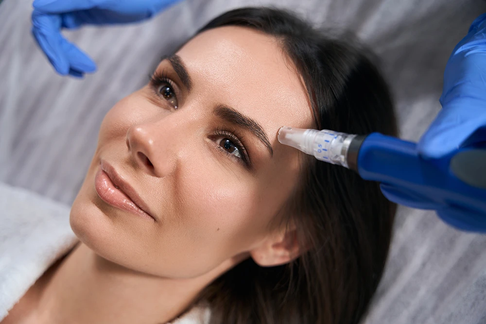 What Is Microneedling? Everything You Need to Know