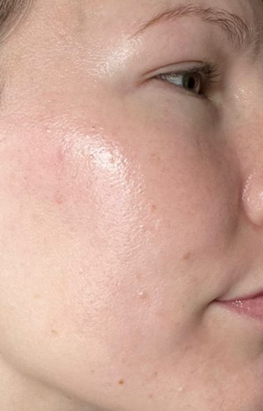 After treatment photo