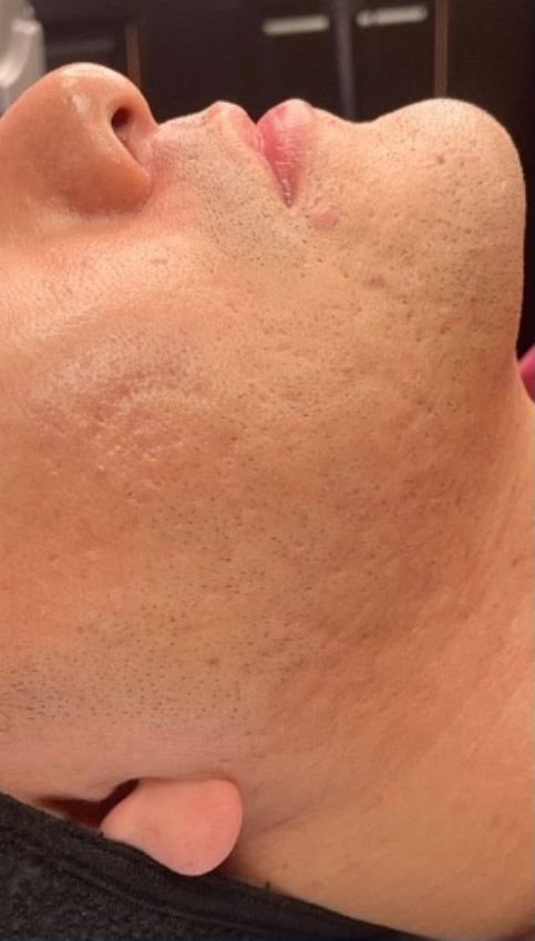 After treatment photo