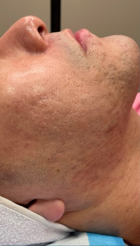 Before treatment photo